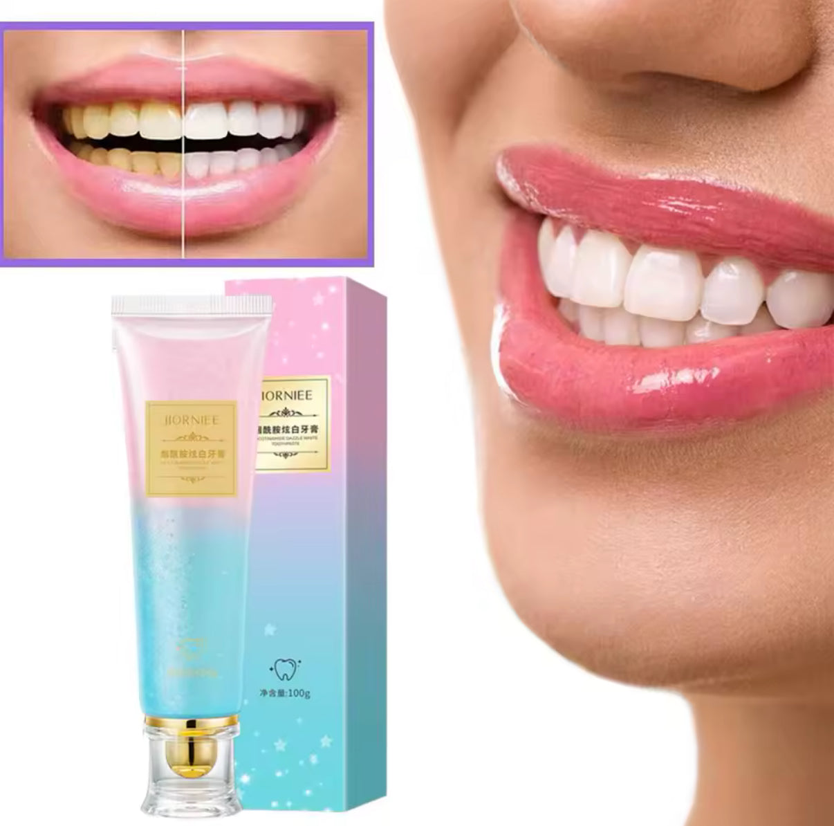 🦷 LumiDent Auki