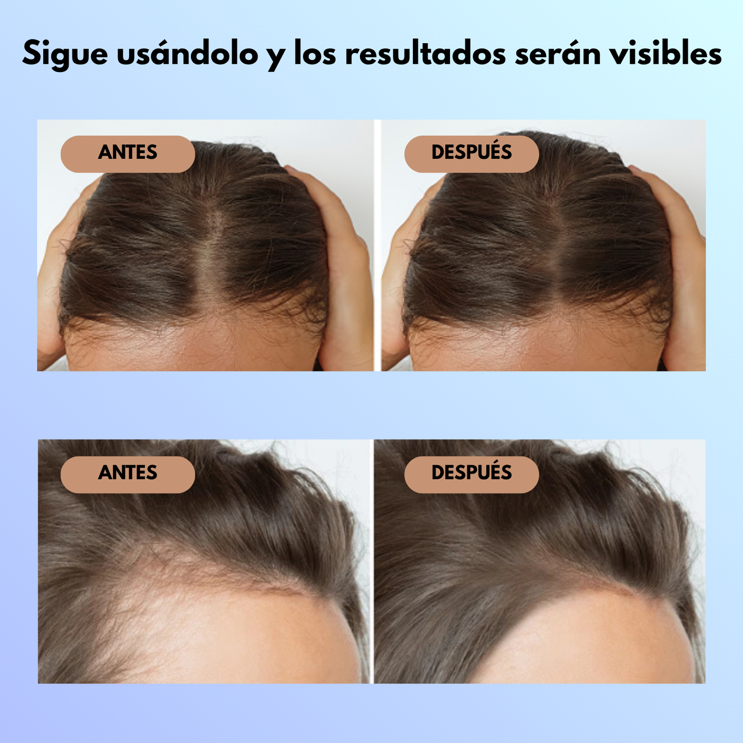💧 Serum Reparador Capilar